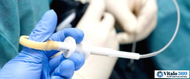 Biopsy: Understanding Cancer Diagnosis Through Biopsy Procedures Biopsy: Understanding Cancer Diagnosis Through Biopsy Procedures