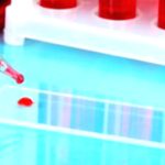 Low Blood Cell Count After Cancer Treatment: What You Need to Know