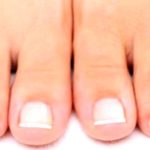 Beat the Heat: Say Goodbye to Sweaty Summer Feet!