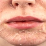 Unlock Your Best Skin: Medical vs. At-Home Peels – What’s the Difference?