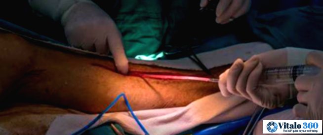 Is Ignoring Leg Pain Really That Risky? Let’s Find Out.