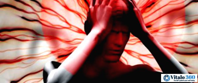 Migraines and Stroke Risk: What You Need to Know.
