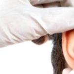 Cauliflower Ear: Key Facts You Should Know