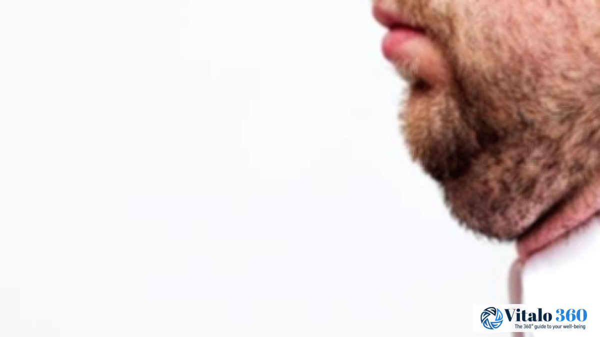 Double Chin: Causes and Effective Removal Methods