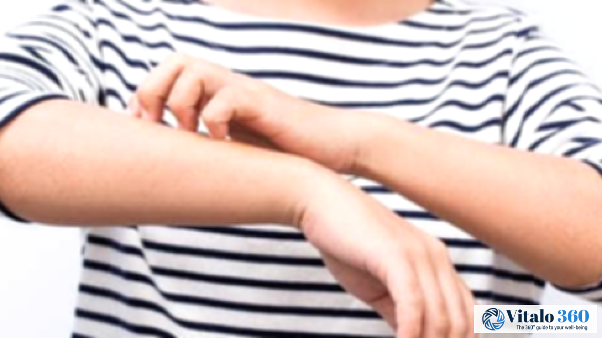 Ingrown Hairs: Causes, Treatment, and Prevention Tips