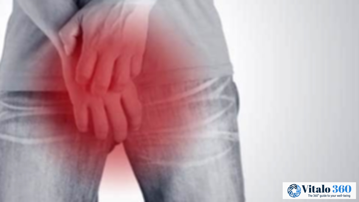 Jock Itch: Causes, Symptoms, and Prevention Tips