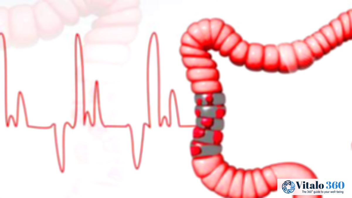 5 Foods Your Colon Will Thank You For 5 Foods Your Colon Will Thank You For