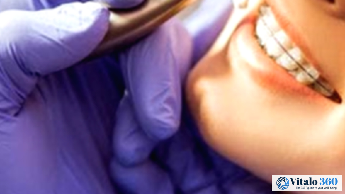 Dental Checkups: Your Questions Answered