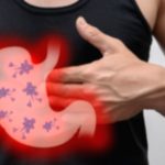 H. Pylori: Your Comprehensive Guide to Symptoms & Treatment