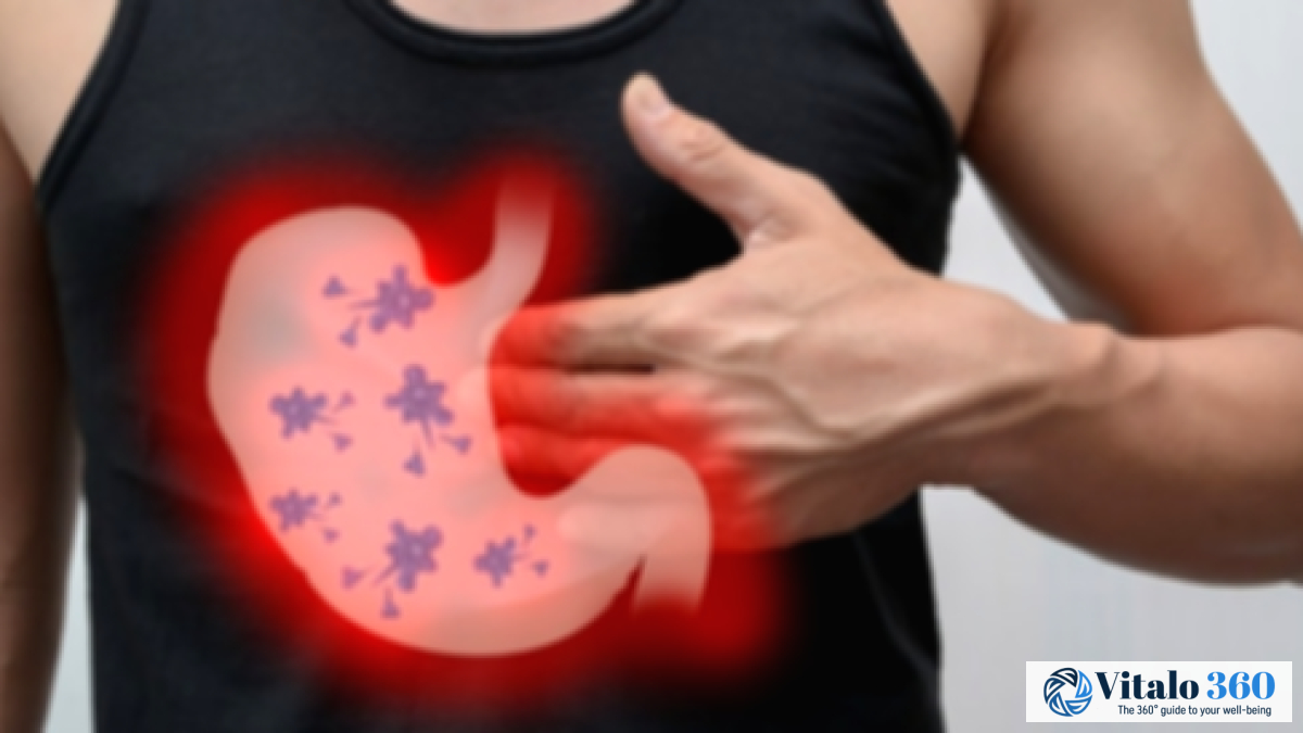 H. Pylori: Your Comprehensive Guide to Symptoms & Treatment