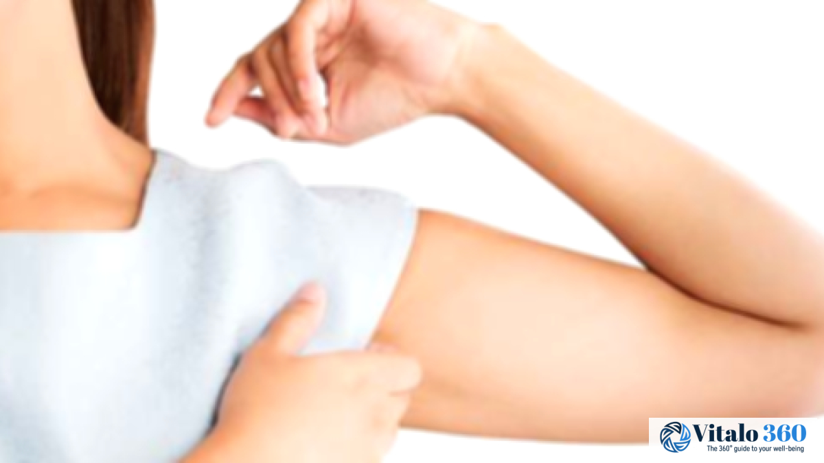Underarm Rash: Causes, Symptoms, and Effective Treatment