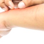 Wrist Rash? Possible Causes and How to Find Relief
