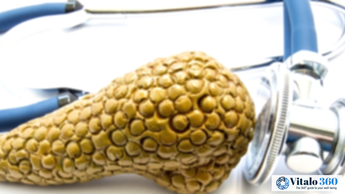 Acute Pancreatitis: Your Comprehensive Guide