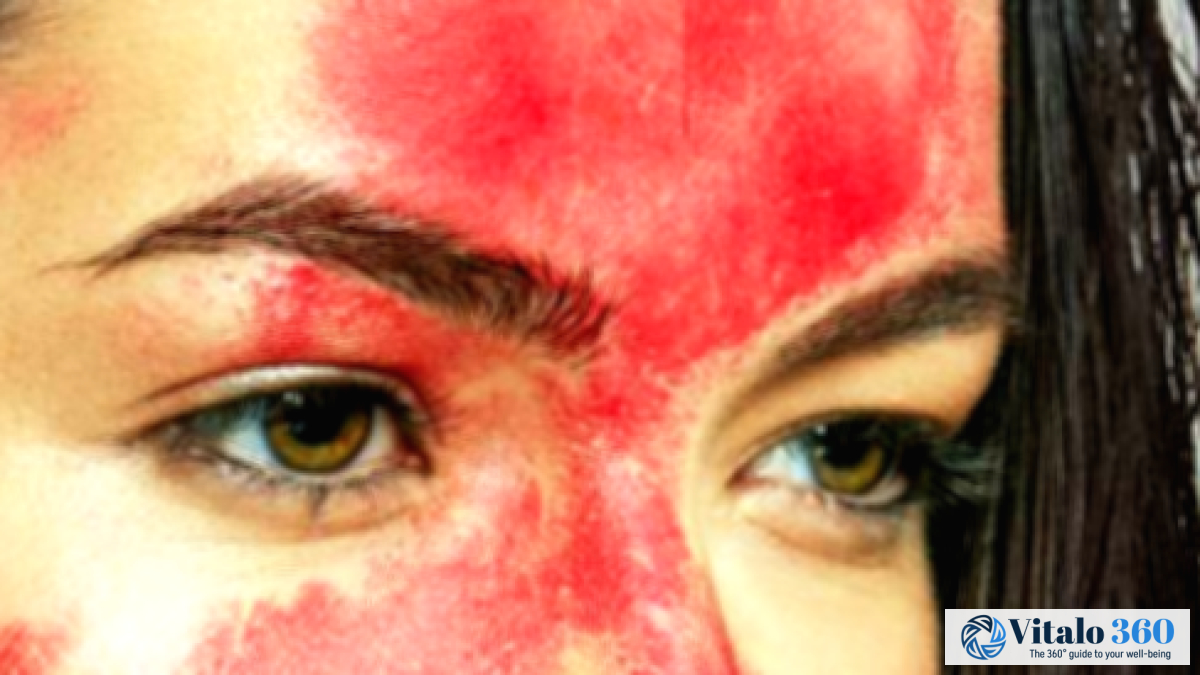 Bloody Sweat: Understanding This Rare Medical Condition