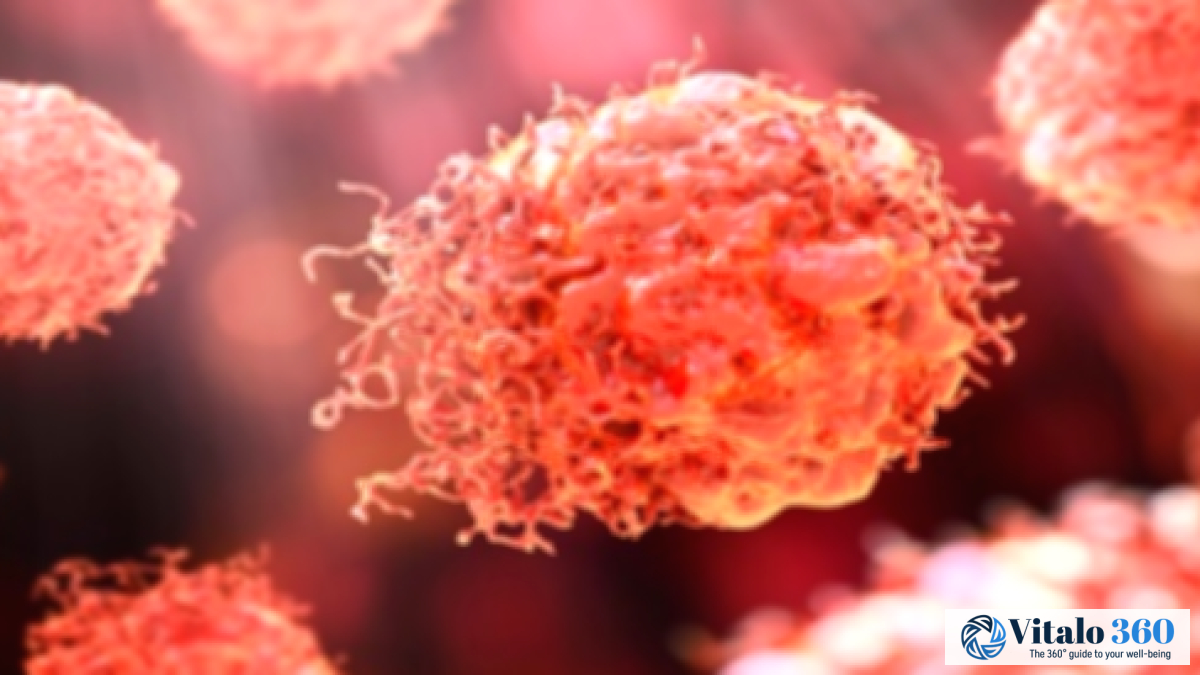 Eye Cancer: A Serious Threat to Your Health