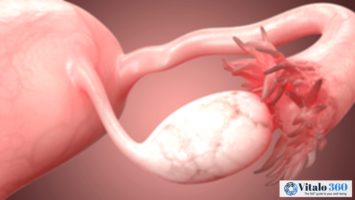 Fallopian Tube Blockage: What You Need to Know