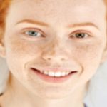 Heterochromia Iridum: Comprehensive Guide