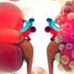 Kidney Cysts: What You Absolutely Need to Know