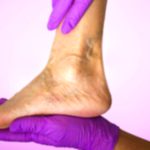 Lower Leg Pain: Possible Causes and Relief Tips