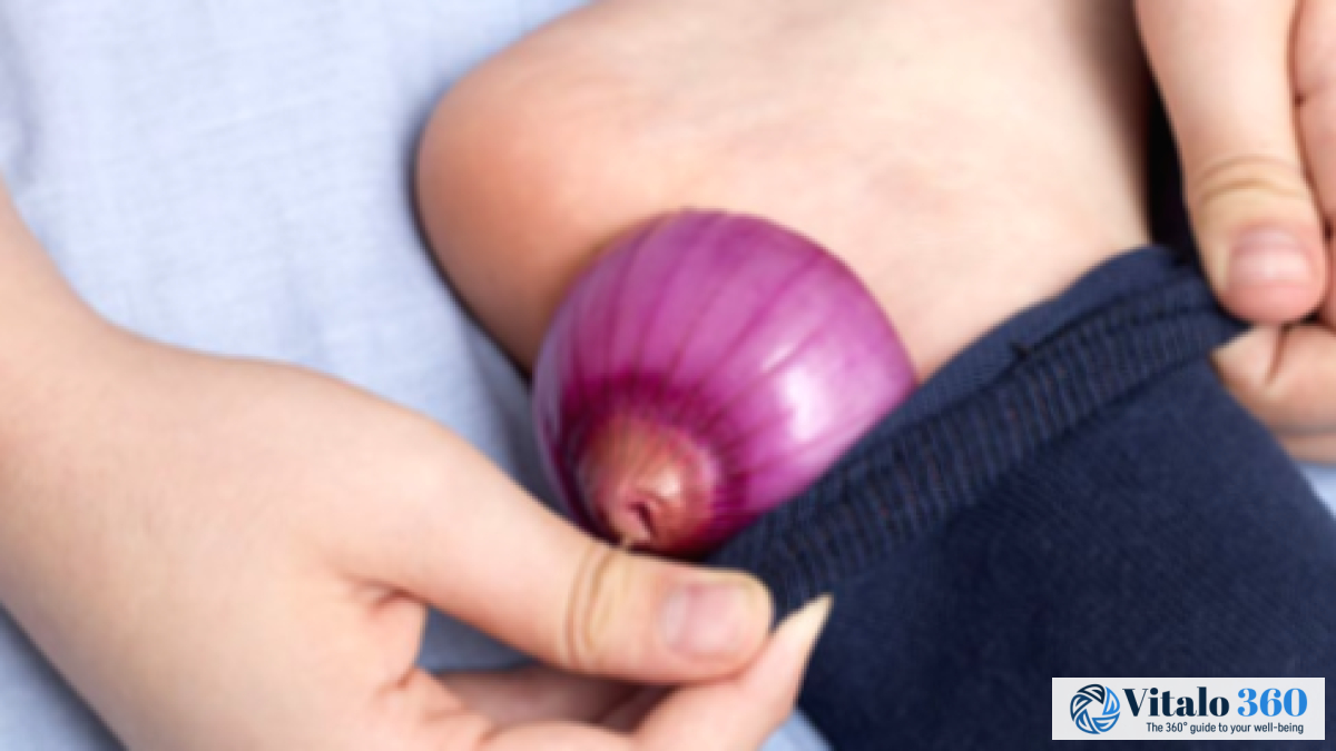 Onion in Socks for Colds? Separating Fact From Fiction