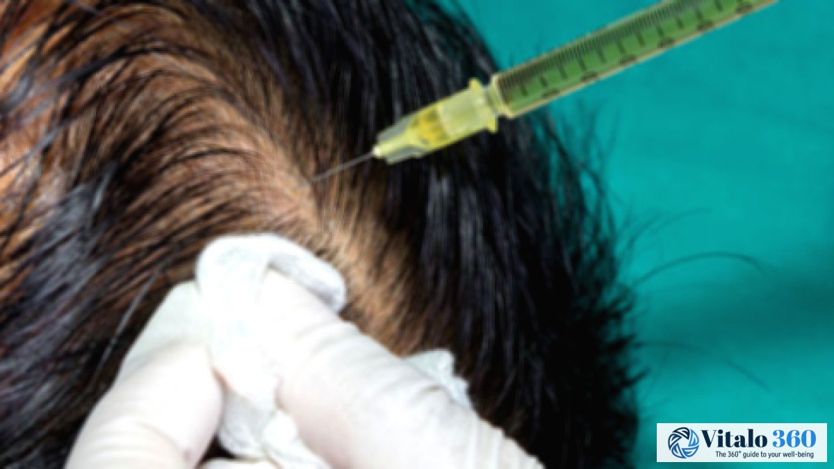 Platelet-Rich Plasma (PRP) Injections: Key Details