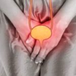 UTI in Women: Symptoms, Causes, & Treatment