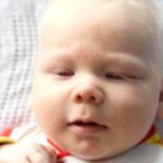 Vitiligo: Key Facts You Need to Know Now Vitiligo: Key Facts You Need to Know Now