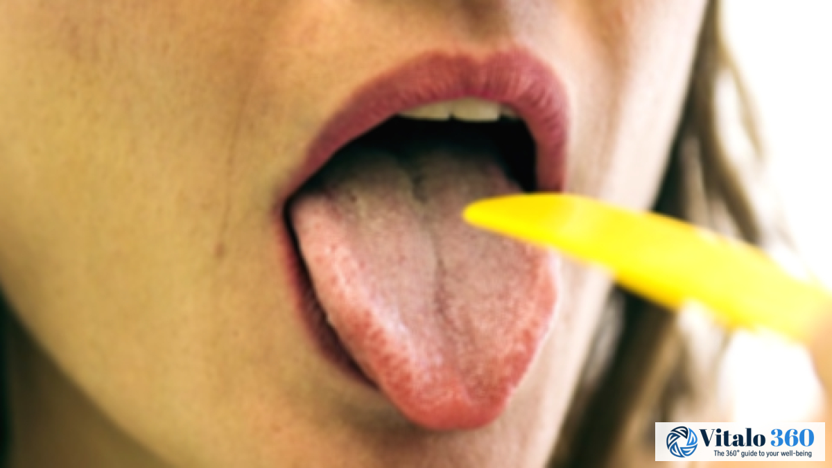 White Tongue Causes: What You Need to Know