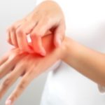 Soothing Itch Relief: Proven Methods & Recipes