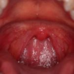 Sore Throat Relief: Simple Remedies & Natural Recipes sore throat relief simple remedies natural recipes
