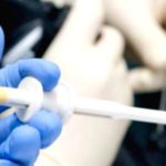 Biopsy: Understanding Cancer Diagnosis Through Biopsy Procedures