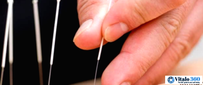 Cancer Alternative Treatments: 11 Options to Consider