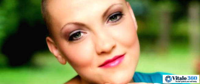 Chemo and Hair Loss: What to Expect Chemo and Hair Loss: What to Expect