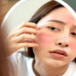 Facial Redness: Easy Ways to Calm the Flush Facial Redness: Easy Ways to Calm the Flush