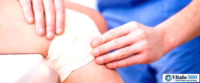 Knee Replacement: Your Complete Guide