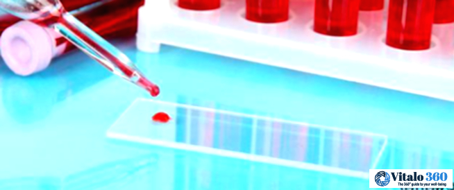 Low Blood Cell Count After Cancer Treatment: What You Need to Know