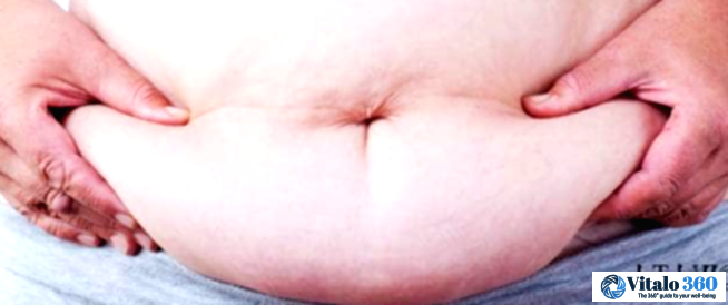 Men's Belly Fat: Why Losing It Matters Men’s Belly Fat: Why Losing It Matters