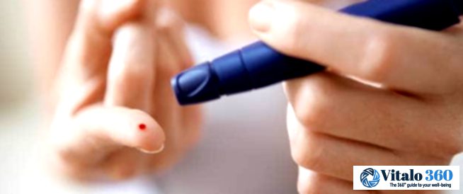 Diabetes and Hair Loss: What’s the Connection?