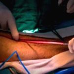 Is Ignoring Leg Pain Really That Risky? Let's Find Out. Is Ignoring Leg Pain Really That Risky? Let’s Find Out.