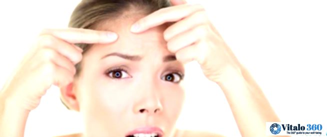 Oily Skin Got You Down? Conquer the Shine!