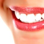 Hollywood Smile: Is it really worth it?