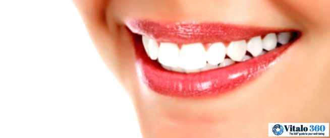 Hollywood Smile: Is it really worth it?