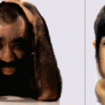 Werewolf Syndrome: Unmasking the Facts