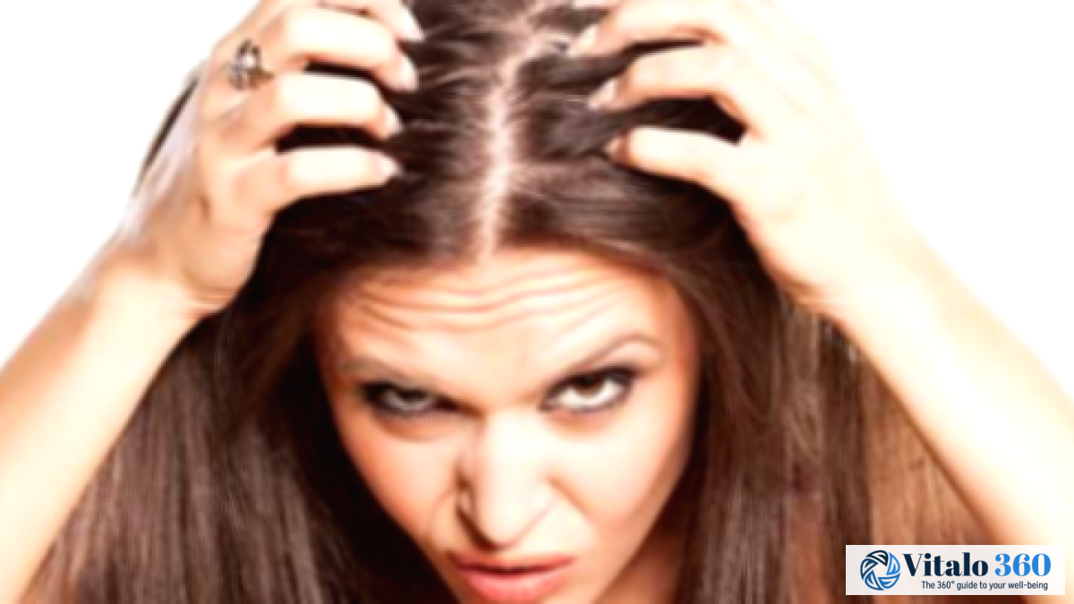 Alopecia Areata: Your Questions Answered
