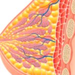 Dense Breast Tissue: What It Means for Your Health