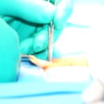 Hernia Types, Symptoms, & Treatment: Key Facts Hernia Types, Symptoms, & Treatment: Key Facts