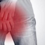 Jock Itch: Causes, Symptoms, and Prevention Tips