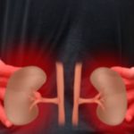 Kidney Failure Symptoms: 6 Key Warning Signs to Know