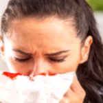 Nosebleeds: Causes, Treatment, and Prevention Tips