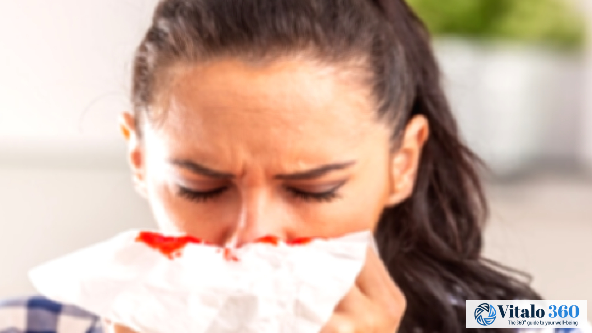 Nosebleeds: Causes, Treatment, and Prevention Tips